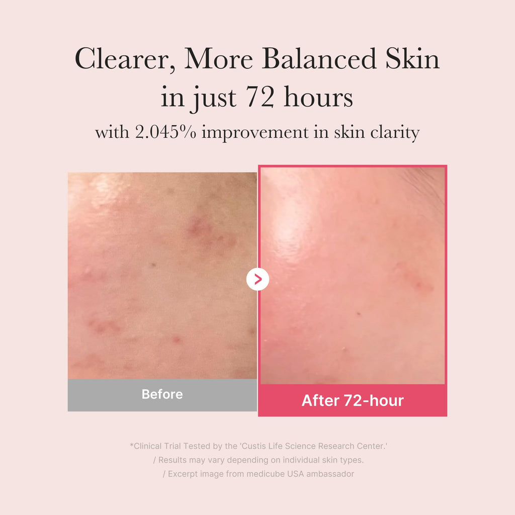 Medicube TXA + Niacinamide 15% Glow Face Serum – Post-Blemish Care, Korean Skincare, Uneven Tone, Texture & Hydration, 5% Tranexamic Acid