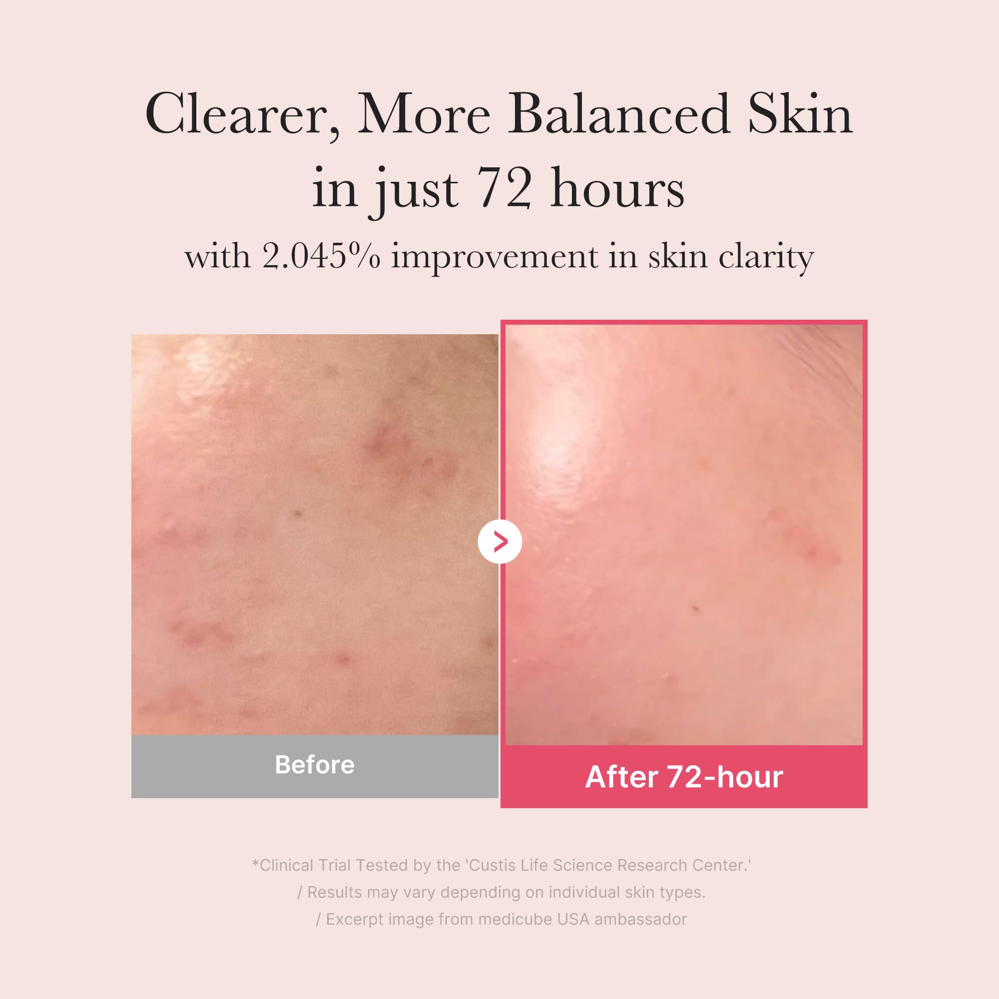 Medicube TXA + Niacinamide 15% Glow Face Serum – Post-Blemish Care, Korean Skincare, Uneven Tone, Texture & Hydration, 5% Tranexamic Acid