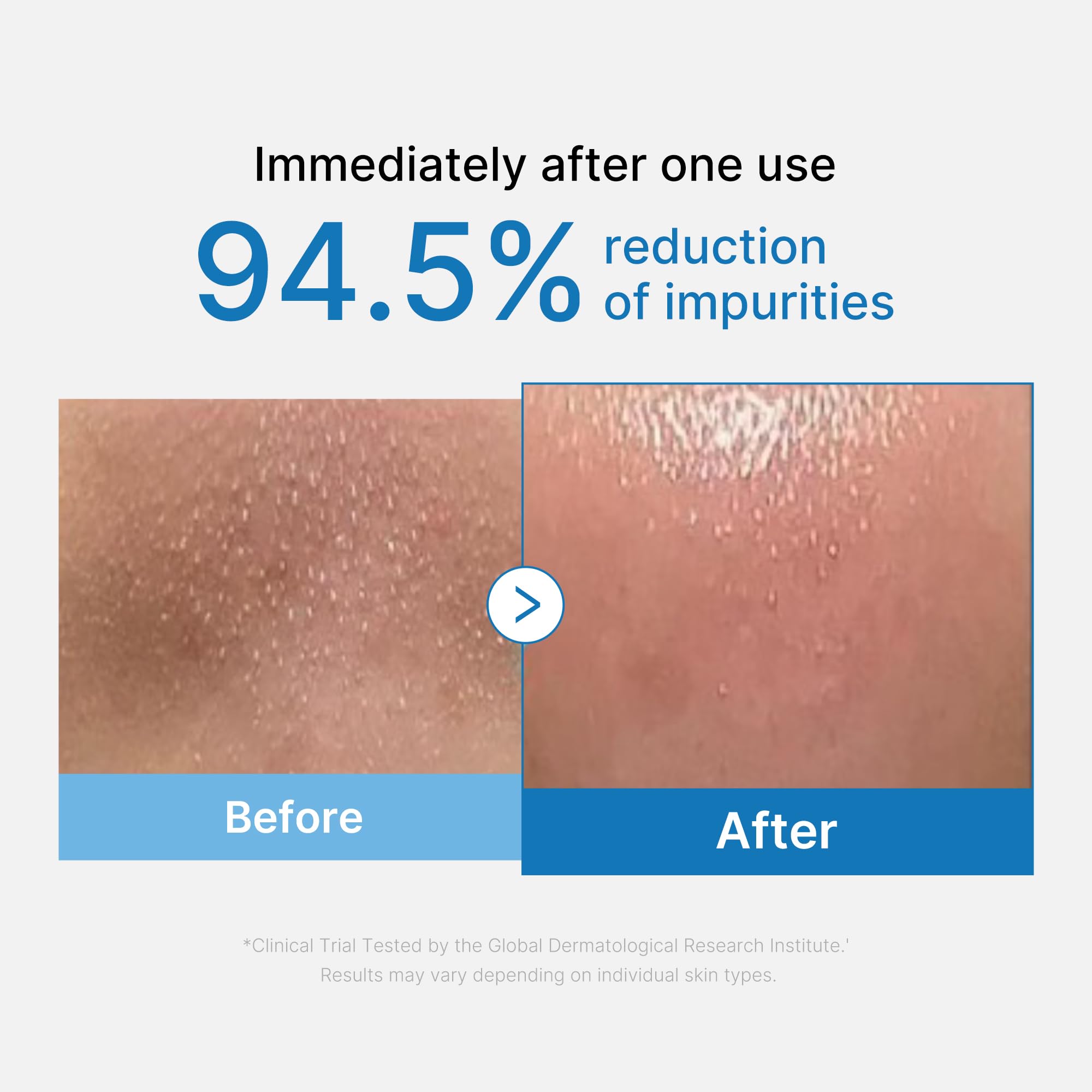 Medicube Zero Pore Blackhead Cleansing Oil – Makeup Remover for All Skin Types, Daily Moisturizing Low-Irritation Face Cleanser, Korean Skincare 205ml