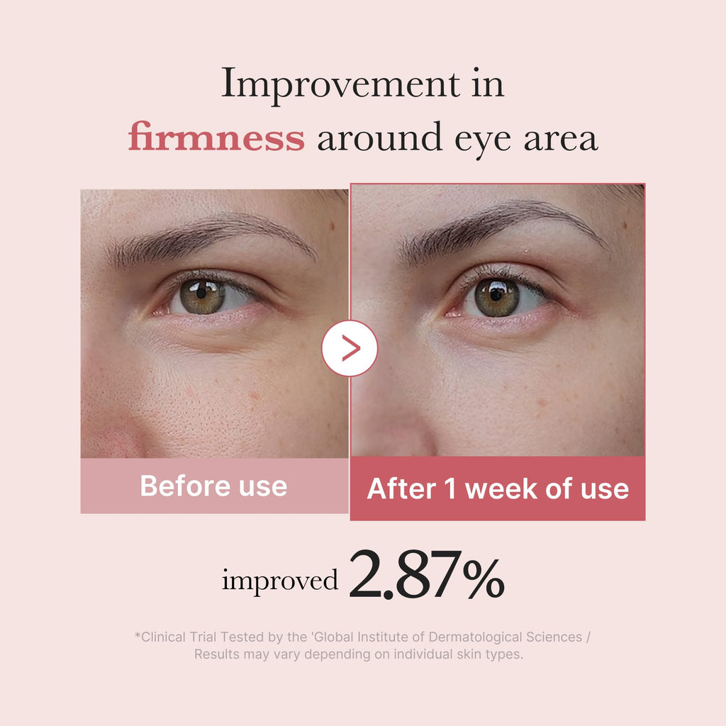 Medicube Pink Peptide Eye Serum – Salmon DNA PDRN, Niacinamide & 99% Pure Retinol for Fine Lines, Dark Circles, Korean Skincare 1.01 fl oz