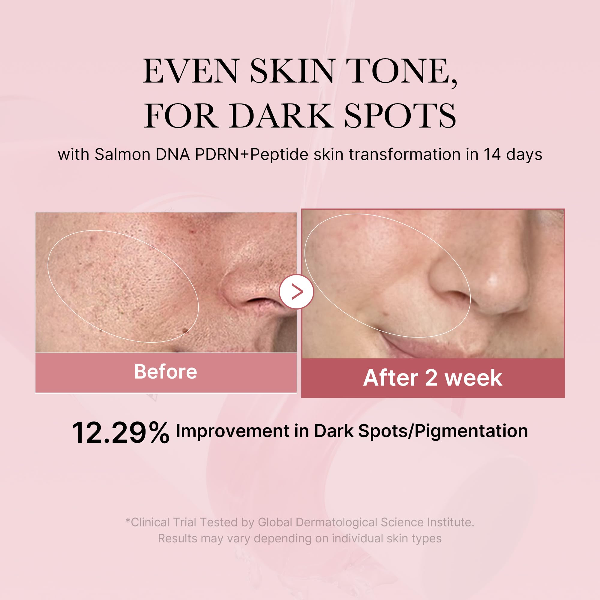 medicube Salmon DNA PDRN Pink CICA Soothing Toner I Pink Glow Toner for Skin Boosting, Soothing and Calming, Uneven Skin Tone, Peptide & Niacinamide, Korean Skin Care (250ml / 8.45 fl. oz.)